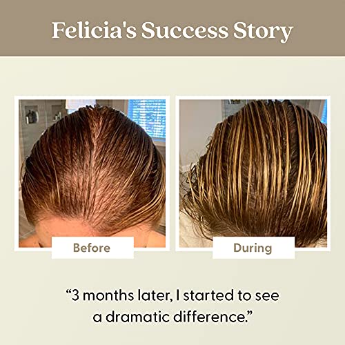 Anneler için Doğum Sonrası Saç Dökülmesi Şampuanı ve Saç Kremi Seti, DHT Fighting Vegan Formülleri Hamilelikten önce ve sonra